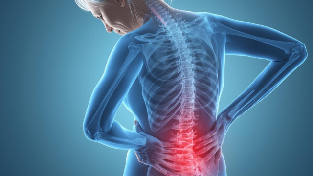 אוסטאופורוזיס